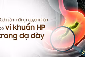 "Vạch trần" những nguyên nhân có vi khuẩn HP trong dạ dày