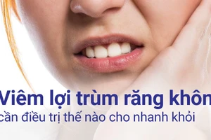 Viêm lợi trùm răng khôn gây đau nhức và ảnh hưởng đến sinh hoạt hàng ngày