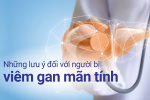 Những lưu ý đối với người bị viêm gan mãn tính