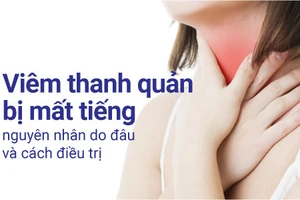 Viêm thanh quản bị mất tiếng khi tình trạng viêm diễn ra nặng