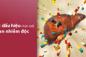 Gan nhiễm độc có thể dẫn đến suy gan