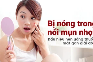 Nổi nhiều mụn, da mẩn ngứa là dấu hiệu cảnh báo gan có vấn đề