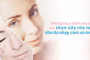 Phải rất chú ý khi chọn sữa rửa mặt cho da nhạy cảm và mụn