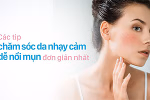 Chăm sóc da nhạy cảm dễ nổi mụn là điều không đơn giản