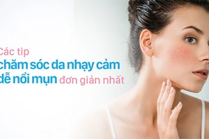 Chăm sóc da nhạy cảm dễ nổi mụn là điều không đơn giản