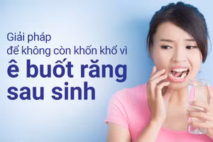 Ê buốt răng sau sinh là tình trạng thường gặp ở chị em