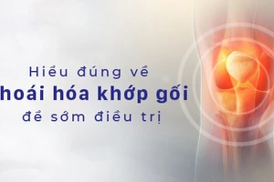 Hiểu đúng về thoái hóa khớp gối để có phương pháp điều trị thích hợp