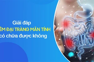 Viêm đại tràng mãn tính ảnh hưởng lớn sinh hoạt và cuộc sống