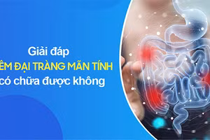 Viêm đại tràng mãn tính ảnh hưởng lớn sinh hoạt và cuộc sống