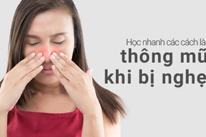 Học nhanh các cách làm thông mũi khi bị nghẹt