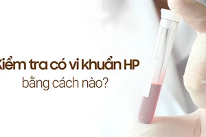 Kiểm tra có vi khuẩn HP bằng cách nào để chẩn đoán chính xác?