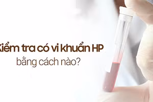 Kiểm tra có vi khuẩn HP bằng cách nào để chẩn đoán chính xác?
