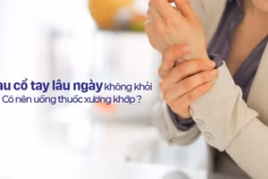Đau cổ tay lâu ngày không khỏi có nên uống thuốc xương khớp?