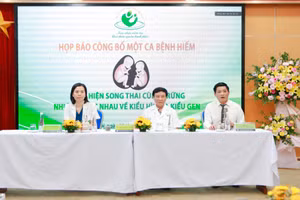 Buổi họp báo do Bệnh viện Phụ sản tổ chức vào chiều 9/11/2022 để công bố về ca bệnh song thai cực hiếm, cùng trứng nhưng khác nhau 100%.