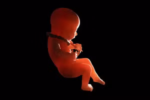 Thai nhi song sinh trong não bé gái 1 tuổi ở Trung Quốc