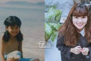 Ảnh thuở bé của hot girl phố núi sở hữu lúm đồng tiền "chết người"