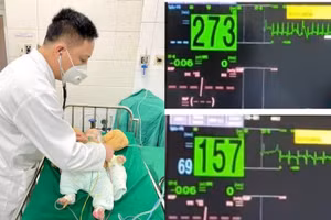 Nhịp tim của trẻ trước và sau khi làm nghiệm pháp.
