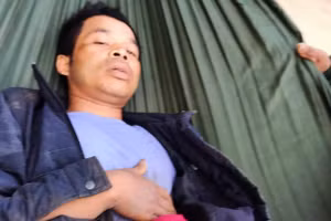 Nam thanh niên nhập viện điều trị do bị trâu húc làm bị thương.