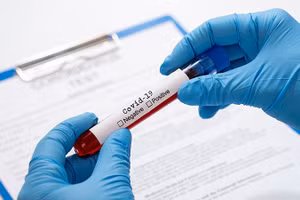 Hiện có 38 người tiếp xúc gần với ca nhiễm SARS-CoV-2 được lấy mẫu xét nghiệm (Ảnh:IT)