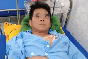 Chủ nuôi bị chó dữ cắn trọng thương. (Ảnh: TT)