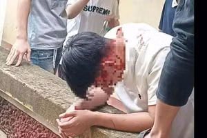 Hình ảnh nam sinh bị đánh thương tích.