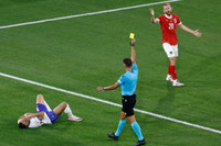 Chùm ảnh: Mbappe gãy xương mũi, phải đeo mặt nạ ở EURO 2024 