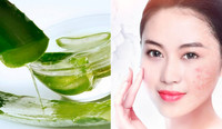 Thần dược tự nhiên trị mụn, chị em nào cũng cần 