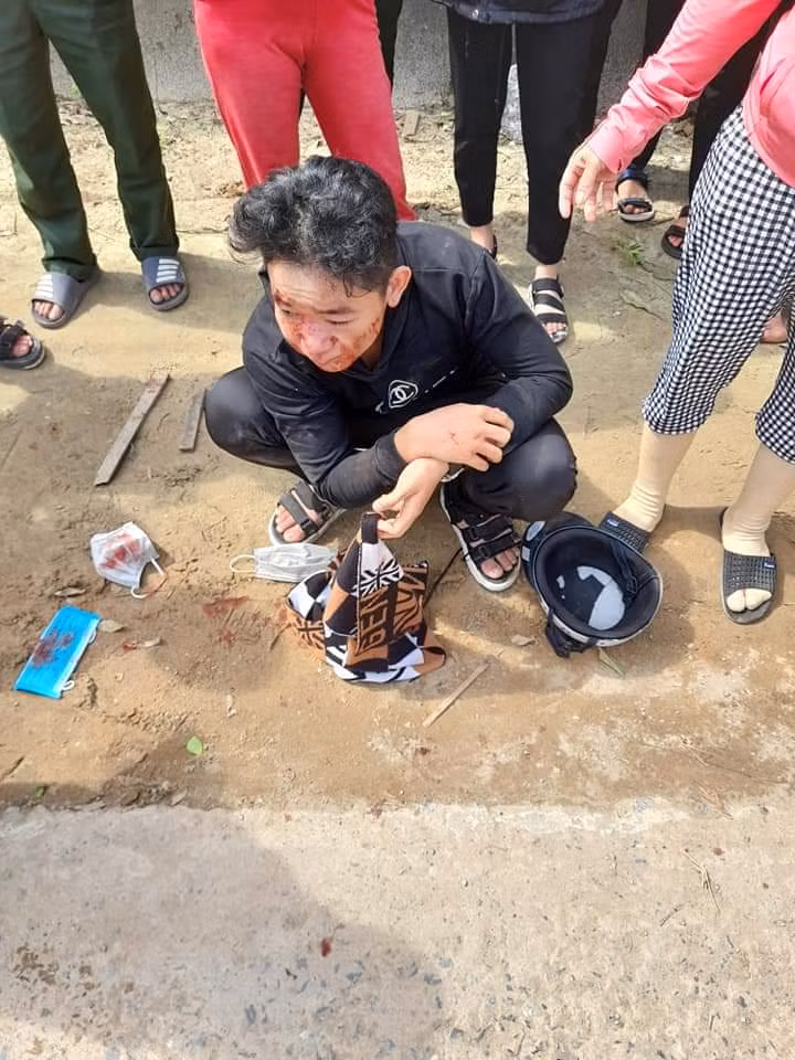 Học sinh N.V.X bị đánh chảy máu vùng mặt và có dấu hiệu bất tỉnh khoảng 20 phút và sau đó được đưa đi bệnh viện.