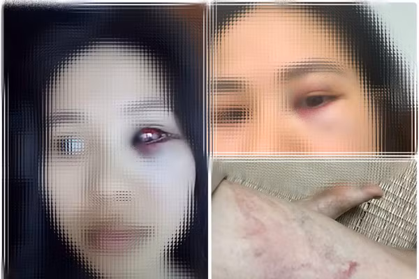Một số hình ảnh trên bài đăng được cho là của người vợ tố thầy giáo bạo hành.