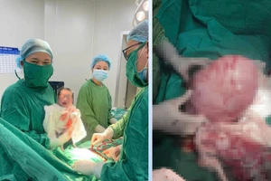 Bé trai nặng 2,6kg được chào đời khỏe mạnh sau khi các y bác sĩ thực hiện thành công ca phẫu thuật.