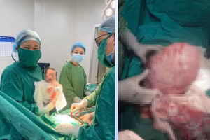 Bé trai nặng 2,6kg được chào đời khỏe mạnh sau khi các y bác sĩ thực hiện thành công ca phẫu thuật.