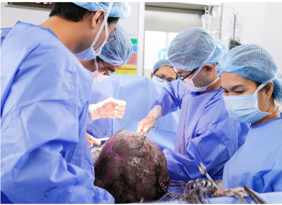 Ê kíp bác sĩ phẫu thuật xử lý khối u xơ nặng 12 ký. 