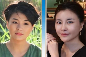 NSƯT Kim Oanh trẻ đẹp ngỡ ngàng sau phẫu thuật thẩm mỹ 