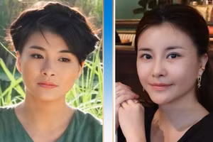 NSƯT Kim Oanh trẻ đẹp ngỡ ngàng sau phẫu thuật thẩm mỹ 