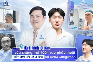 Chuyển vạt da giúp điều trị hở hàm ếch tạo hình mũi