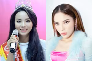 Hoa hậu Kỳ Duyên khẳng định đẹp tự nhiên, không phẫu thuật thẩm mỹ