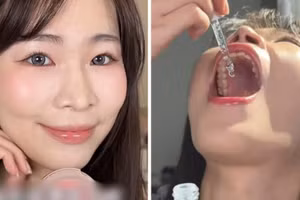 Hotgirl 'ăn mỹ phẩm' đình đám đột ngột qua đời