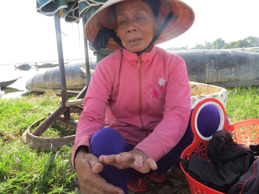 Theo thời gian đôi bàn tay trở nên chây lì vì ngâm nước giậm trìa