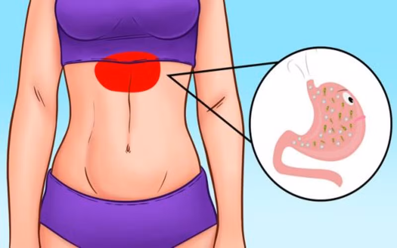 Căng thẳng có thể dẫn tới các bệnh về đường tiêu hóa.