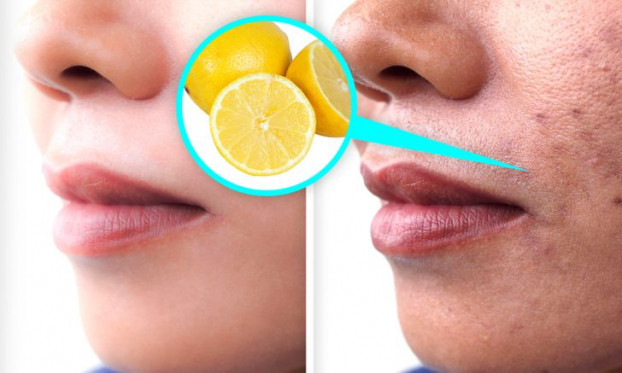Chanh là loại quả rất phổ biến trong làm đẹp. 5