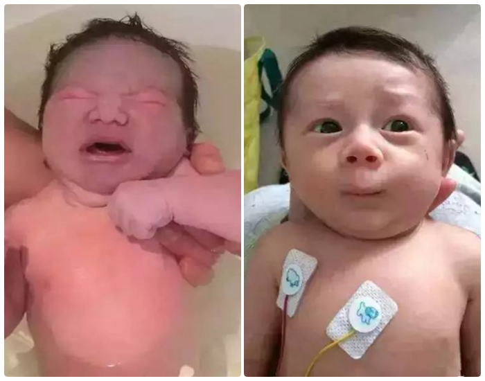 Những người lần đầu làm cha mẹ chắc chắn cảm thấy đau đầu vì con sinh ra "quá xấu", khác xa với những gì họ vẫn hình dung về trẻ sơ sinh. Những người lần đầu làm cha mẹ chắc chắn cảm thấy đau đầu vì con sinh ra