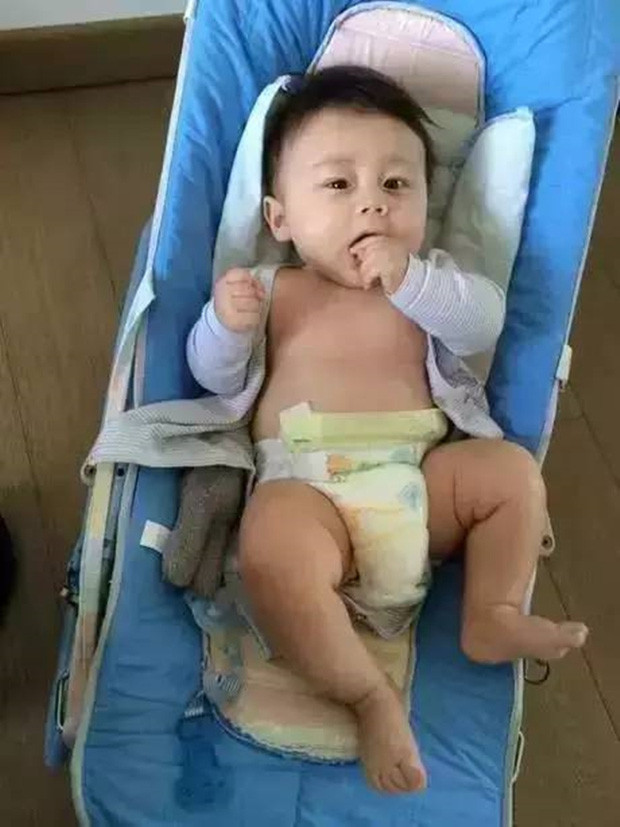 Đứa trẻ có cuộc "lột xác" ngoạn mục chỉ sau vài tháng. Đứa trẻ có cuộc