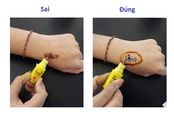 Nếu chẳng may bị thương, bạn đừng nên bôi thuốc vào trực tiếp mà hãy bôi ở phần rìa xung quanh thôi nhé. Nếu chẳng may bị thương, bạn đừng nên bôi thuốc vào trực tiếp mà hãy bôi ở phần rìa xung quanh thôi nhé.