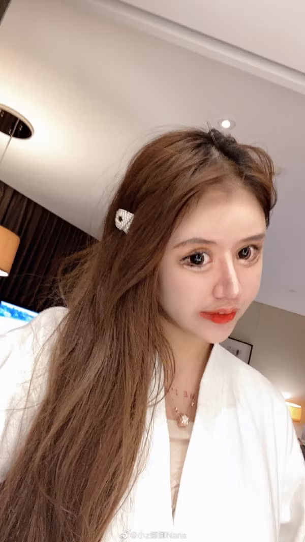 Lạm dụng những công nghệ thẩm mỹ như gọt xương cằm, cắt mí, thu nhọn cánh mũi... mà tiểu thư xứ Trung phải lãnh hậu quả không thể nào cải thiện trở lại được.