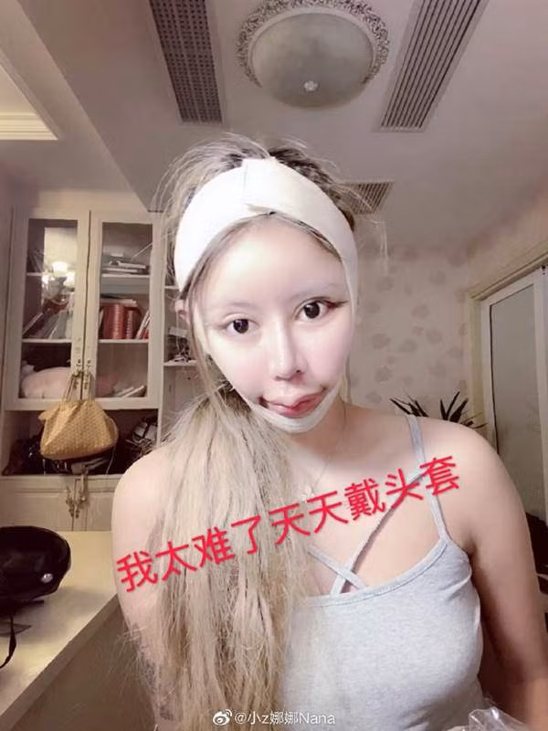 Chỉ dao kéo khi thực sự cần thiết.