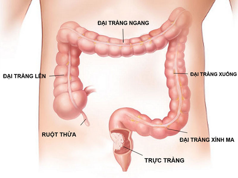 Tìm hiểu đại tràng là gì và các bệnh đại tràng thường gặp ảnh 1 đại tràng là gì