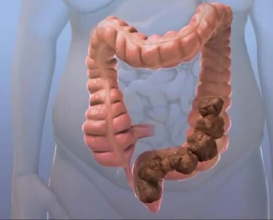 Táo bón ăn gì để đi ngoài dễ dàng hơn? ảnh 1 táo bón ăn gì