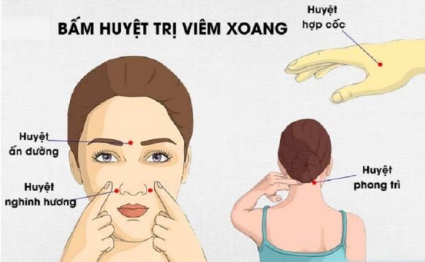 nghẹt mũi do viêm xoang