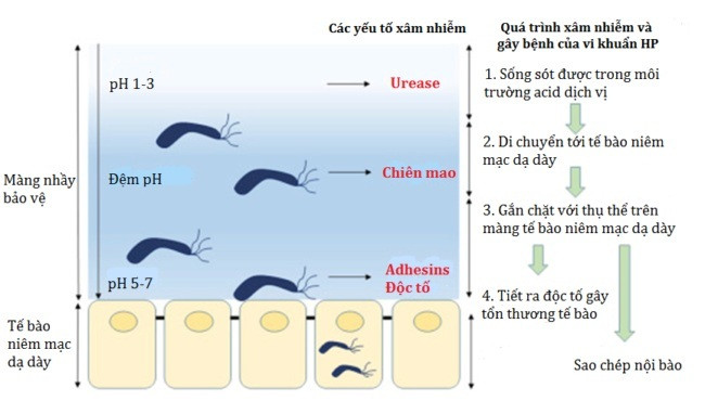 Tìm hiểu các phương pháp điều trị viêm dạ dày HP hiệu quả ảnh 2 Viêm dạ dày HP