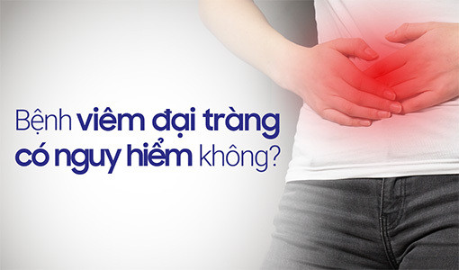 Chuyên gia giải đáp "Bệnh viêm đại tràng có nguy hiểm không?" ảnh 1 Viêm đại tràng